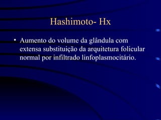 Hashimoto- Hx Aumento do volume da glândula com extensa substituição da arquitetura folicular normal por infiltrado linfoplasmocitário. 