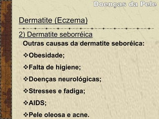 Dermatite (Eczema)
2) Dermatite seborréica
crosta láctea, caspa, seborréica.
Condição da pele caracterizada por
escamas brancas gordurosas ou secas, com
ou sem a associação de pele ruborizada.
A causa da dermatite seborréica é desconhecida
mas a oleosidade excessiva e um fungo
Pityrosporum ovale presente na pele
afetada estão envolvidos no processo.
Outras causas da dermatite seboréica:
Obesidade;
Falta de higiene;
Doenças neurológicas;
Stresses e fadiga;
AIDS;
Pele oleosa e acne.
 