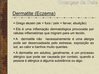 Dermatite (Eczema)
 Grego ekzein (ek = fora / zein = ferver, ebulição)
 Ela é uma inflamação dermatológica provocada por
células inflamatórias que migram para um tecido.
 A dermatite não necessariamente é uma alergia
pode ser desencadeada pelo estresse, exposição ao
sol, ao calor e banhos muito quentes.
 A dermatite em adultos, geralmente, é um processo
alérgico que pode ser causada por contato, quando a
pessoa é alérgica a alguma substância ou algo.
 