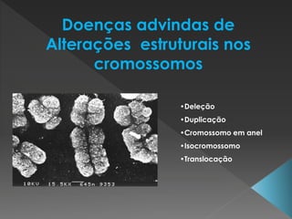 Doenças advindas de 
Alterações estruturais nos 
cromossomos 
•Deleção 
•Duplicação 
•Cromossomo em anel 
•Isocromossomo 
•Translocação 
 