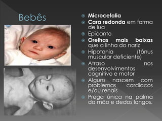  Microcefalia 
 Cara redonda em forma 
de lua 
 Epicanto 
 Orelhas mais baixas 
que a linha do nariz 
 Hipotonia (tônus 
muscular deficiente) 
 Atraso nos 
desenvolvimentos 
cognitivo e motor 
 Alguns nascem com 
problemas cardíacos 
e/ou renais 
 Prega única na palma 
da mão e dedos longos. 
 