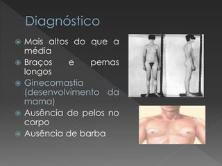  Mais altos do que a 
média 
 Braços e pernas 
longos 
 Ginecomastia 
(desenvolvimento da 
mama) 
 Ausência de pelos no 
corpo 
 Ausência de barba 
 