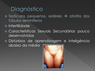  Testículos pequenos, estéreis  atrofia dos 
túbulos seminíferos 
 Infertilidade 
 Características Sexuais Secundárias pouco 
desenvolvidas 
 Distúrbios de aprendizagem e inteligência 
abaixo da média 
 