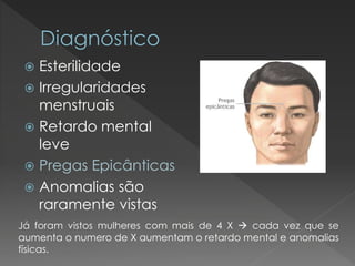  Esterilidade 
 Irregularidades 
menstruais 
 Retardo mental 
leve 
 Pregas Epicânticas 
 Anomalias são 
raramente vistas 
Já foram vistos mulheres com mais de 4 X  cada vez que se 
aumenta o numero de X aumentam o retardo mental e anomalias 
físicas. 
 