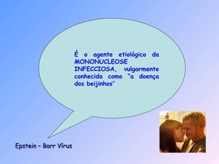 Epstein – Barr VírusEpstein – Barr Vírus
É o agente etiológico da
MONONUCLEOSE
INFECCIOSA, vulgarmente
conhecida como “a doença
dos beijinhos”
 