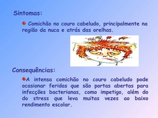Comichão no couro cabeludo, principalmente na
região da nuca e atrás das orelhas.
Sintomas:
A intensa comichão no couro cabeludo pode
ocasionar feridas que são portas abertas para
infecções bacterianas, como impetigo, além do
do stress que leva muitas vezes ao baixo
rendimento escolar.
Consequências:
 