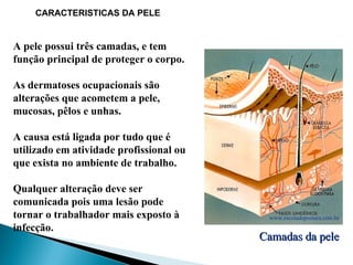 A pele possui três camadas, e tem
função principal de proteger o corpo.
As dermatoses ocupacionais são
alterações que acometem a pele,
mucosas, pêlos e unhas.
A causa está ligada por tudo que é
utilizado em atividade profissional ou
que exista no ambiente de trabalho.
Qualquer alteração deve ser
comunicada pois uma lesão pode
tornar o trabalhador mais exposto à
infecção.
www.escoladepostura.com.br
Camadas da pele
Camadas da pele
CARACTERISTICAS DA PELE
 