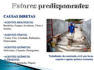 CAUSAS DIRETAS
CAUSAS DIRETAS
•AGENTES BIOLÓGICOS:
AGENTES BIOLÓGICOS:
Bactérias; Fungos; leveduras; Vírus e
Bactérias; Fungos; leveduras; Vírus e
Insetos.
Insetos.
•AGENTES FÍSICOS
AGENTES FÍSICOS:
:
• Calor; Frio; Umidade; Radiações,
Calor; Frio; Umidade; Radiações,
Eletricidade.
Eletricidade.
•AGENTES QUÍMICOS:
AGENTES QUÍMICOS:
•Solventes; Cimento; Detergentes.
Solventes; Cimento; Detergentes.
•AGENTES QUÍMICOS
AGENTES QUÍMICOS
ALÉRGENOS:
ALÉRGENOS:
•Aditivos de borracha; Níquel;
Aditivos de borracha; Níquel;
Cromo; Cobalto.
Cromo; Cobalto.
http://www.rondonia.ro.gov.br
http://www.rondonia.ro.gov.br
Trabalhador da construção civil sem luvas
Trabalhador da construção civil sem luvas
exposto a agente químico (cimento)
exposto a agente químico (cimento)
 