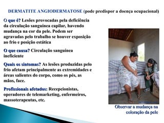 O
O que é?
que é? Lesões provocadas pela deficiência
Lesões provocadas pela deficiência
da circulação sanguínea capilar, havendo
da circulação sanguínea capilar, havendo
mudança na cor da pele. Podem ser
mudança na cor da pele. Podem ser
agravadas pelo trabalho se houver exposição
agravadas pelo trabalho se houver exposição
ao frio e posição estática
ao frio e posição estática
O que causa?
O que causa? Circulação sanguínea
Circulação sanguínea
ineficiente
ineficiente
Quais os sintomas?
Quais os sintomas? As lesões produzidas pelo
As lesões produzidas pelo
frio afetam principalmente as extremidades e
frio afetam principalmente as extremidades e
áreas salientes do corpo, como os pés, as
áreas salientes do corpo, como os pés, as
mãos, face.
mãos, face.
Profissionais afetados:
Profissionais afetados: Recepcionistas,
Recepcionistas,
operadores de telemarketing, enfermeiros,
operadores de telemarketing, enfermeiros,
massoterapeutas, etc.
massoterapeutas, etc.
DERMATITE ANGIODERMATOSE (pode predispor a doença ocupacional)
)
bp3.blogger.com
Observar a mudança na
Observar a mudança na
coloração da pele
coloração da pele
 