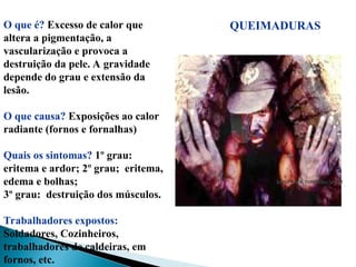 QUEIMADURAS
http://www.vermelho.org.br
http://www.vermelho.org.br
O que é? Excesso de calor que
altera a pigmentação, a
vascularização e provoca a
destruição da pele. A gravidade
depende do grau e extensão da
lesão.
O que causa? Exposições ao calor
radiante (fornos e fornalhas)
Quais os sintomas? 1º grau:
eritema e ardor; 2º grau; eritema,
edema e bolhas;
3º grau: destruição dos músculos.
Trabalhadores expostos:
Soldadores, Cozinheiros,
trabalhadores de caldeiras, em
fornos, etc.
 