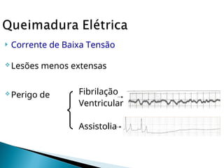  Corrente de Baixa Tensão
Lesões menos extensas
Perigo de Fibrilação
Ventricular
Assistolia
 