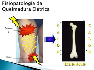 Entrada
(
Saída
(
C
C
A
A
L
L
O
O
R
R
C
C
A
A
L
L
O
O
R
R
Efeito Joule
Efeito Joule
 