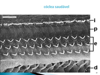 cóclea saudável
61
 