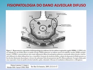 FISIOPATOLOGIA DO DANO ALVEOLAR DIFUSO
 