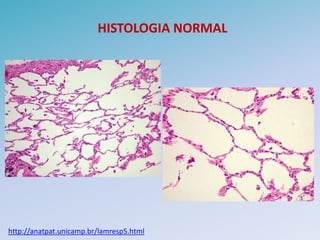 HISTOLOGIA NORMAL




http://anatpat.unicamp.br/lamresp5.html
 