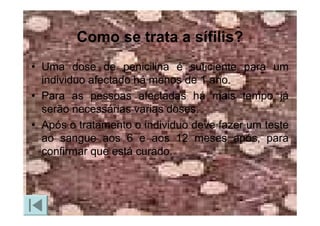 Doencas Sexualmente Transmissiveis