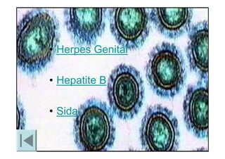 Doencas Sexualmente Transmissiveis