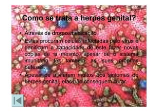 Doencas Sexualmente Transmissiveis