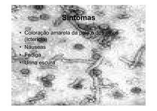 Doencas Sexualmente Transmissiveis