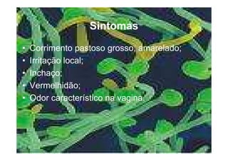 Doencas Sexualmente Transmissiveis