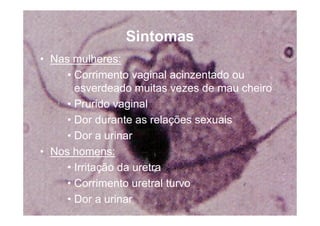 Doencas Sexualmente Transmissiveis