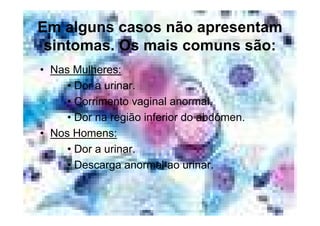 Doencas Sexualmente Transmissiveis