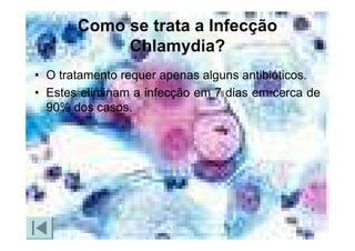 Doencas Sexualmente Transmissiveis