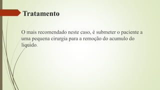 Tratamento
O mais recomendado neste caso, é submeter o paciente a
uma pequena cirurgia para a remoção do acumulo do
liquido.
 