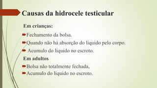 Causas da hidrocele testicular
Em crianças:
Fechamento da bolsa.
Quando não há absorção do liquido pelo corpo.
 Acumulo do liquido no escroto.
Em adultos
Bolsa não totalmente fechada,
Acumulo do liquido no escroto.
 
