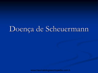 Doença de Scheuermann
www.traumatologiaeortopedia.com.b
 