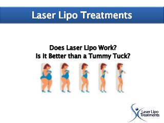 Does Laser Lipo Work?
Is it Better than a Tummy Tuck?
 