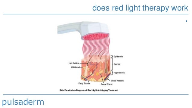 a for therapy work does light therapy work pulsaderm a for therapy work does light therapy work pulsaderm