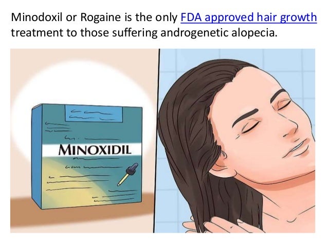 does rogaine help stop hair loss