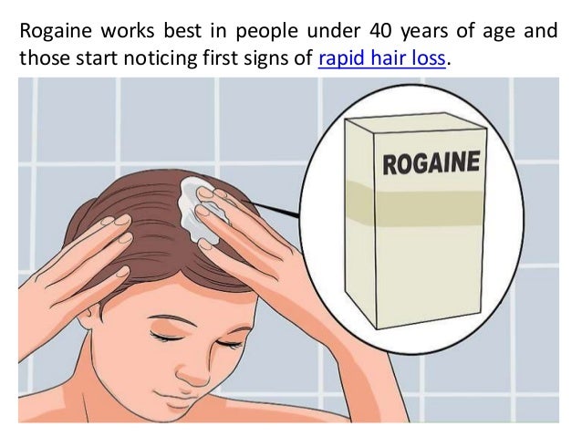Does Rogaine Stop Hair Loss