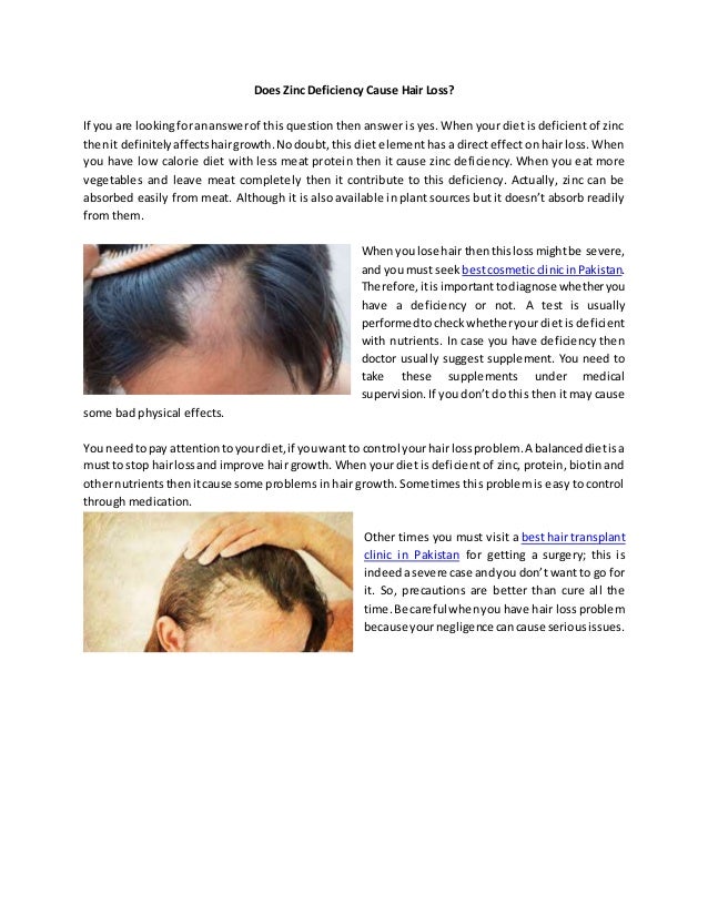 Hair zinc loss and Zinc for