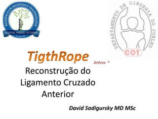 Reconstrução do
Ligamento Cruzado
Anterior
Arthrex ®
David Sadigursky MD MSc
 