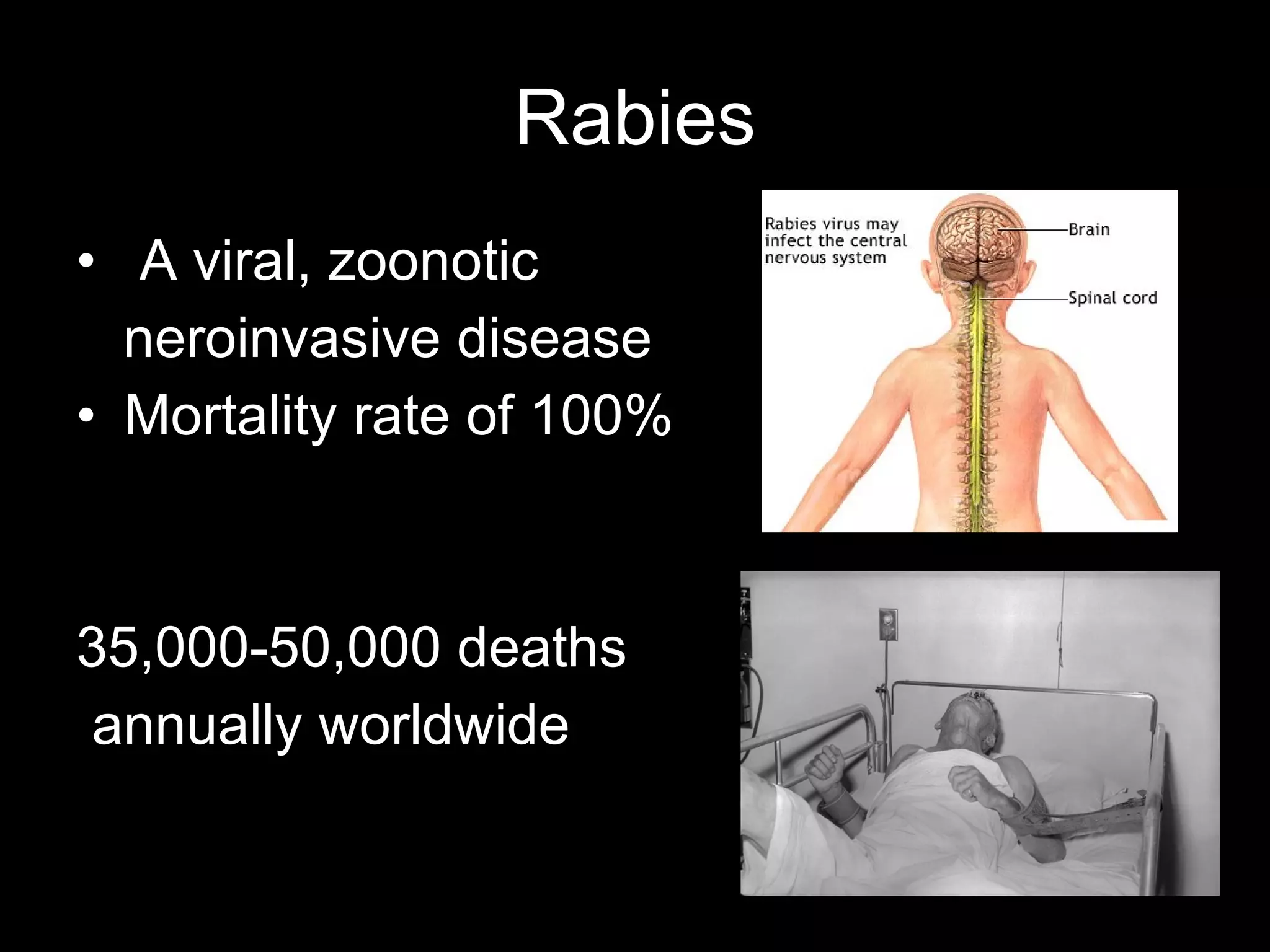 Rabies
• A viral, zoonotic
  neroinvasive disease
• Mortality rate of 100%



35,000-50,000 deaths
annually worldwide
 