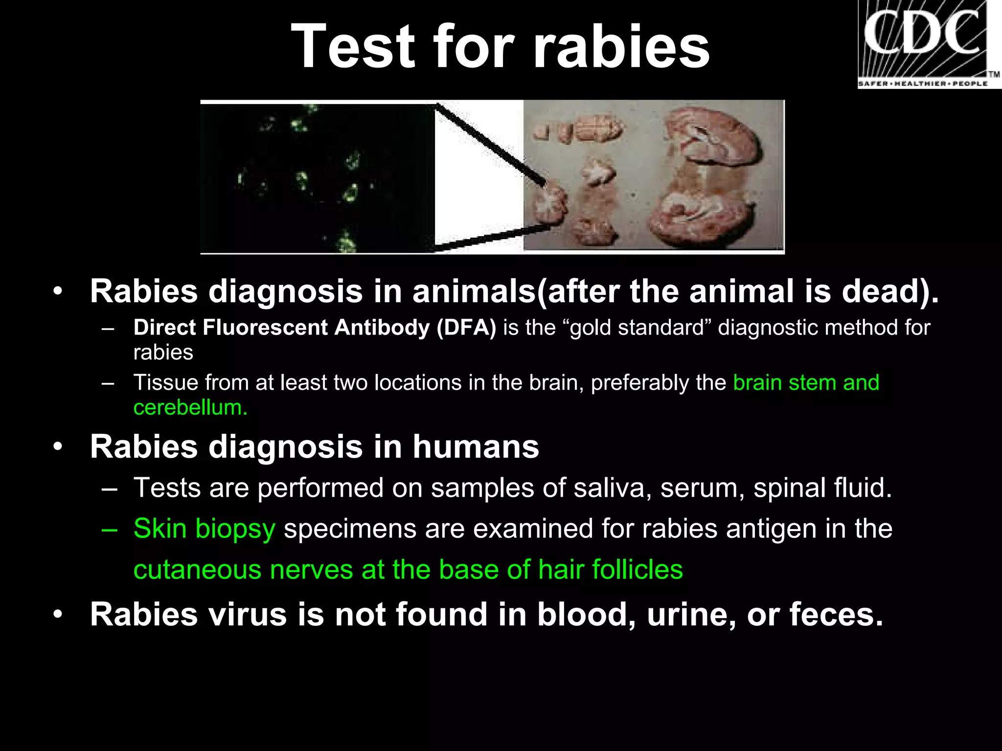 Test for rabies


• Rabies diagnosis in animals(after the animal is dead).
   – Direct Fluorescent Antibody (DFA) is the “gold standard” diagnostic method for
     rabies
   – Tissue from at least two locations in the brain, preferably the brain stem and
     cerebellum.
• Rabies diagnosis in humans
   – Tests are performed on samples of saliva, serum, spinal fluid.
   – Skin biopsy specimens are examined for rabies antigen in the
     cutaneous nerves at the base of hair follicles
• Rabies virus is not found in blood, urine, or feces.
 