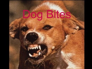 Dog Bites
 