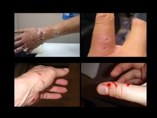 small dog bite treatment