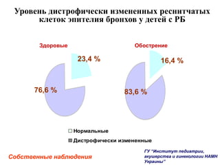 Уровень дистрофически измененных реснитчатых
клеток эпителия бронхов у детей с РБ
Нормальные
Дистрофически измененные
Собственные наблюдения
16,4 %
83,6 %
23,4 %
76,6 %
Здоровые Обострение
ГУ “Институт педиатрии,
акушерства и гинекологии НАМН
Украины”
 