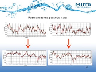27
Разглаживание рельефа кожи
 
