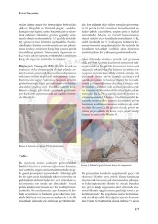 malar daima majör bir hemorajinin belirtisidir.
Arkuat, iliopubik ve ilioiskial çizgiler, asetabu-
lum göz yaﬂ› figürü, sakral foraminalar ve sakro-
iliak eklemler dikkatlice gözden geçirilip siste-
matik olarak incelenmelidir. AP grafide instabili-
teyi gösteren baz› belirtiler saptanabilir. Bunlar-
dan beﬂinci lomber vertebran›n transvers ç›k›nt›-
s›n›n deplase avülziyon k›r›¤› her zaman pelvik
instabiliteyi gösterir. Sakrospinöz ligaman›n is-
kial veya sakral yap›ﬂma yerlerindeki avülziyon
k›r›¤› da di¤er bir instabilite belirtisidir.
Bilgisayarl› Tomografi (BT): Pelvisin kemik ve
yumuﬂak doku elemanlar›n› aksiyel planda ay-
r›nt›l› olarak göstererek fragmanlar›n deplasman
miktar›n› belirler ve pelvisin stabilitesinin de¤er-
lendirmesini sa¤lar. Sakroiliak bölgenin ayr›nt›l›
gösterilmesinde di¤er görüntülüme tekniklerin-
den daha iyi sonuç verir . Özellikle sakrum k›r›k-
lar›nda oldu¤u gibi direkt grafilerde görüleme-
yen k›r›klar›n saptanmas›nda en faydal› yöntem-
dir (Resim 4).
Tedavi
Bu olgularda tedavi yaklaﬂ›m› politravmatize
hastalardaki hava yolunun sa¤lanmas›, kanama-
n›n kontrolü, organ yaralanmalar›n›n tedavisi gi-
bi genel prensipleri içermektedir. Bilindi¤i gibi
bu tür a¤›r yaral› hastalarda iskelet sistemine ait
patolojilerin definitif tedavileri acil müdahale s›-
ralamas›nda son s›rada yer almaktad›r. Ancak
pelvis k›r›klar›n›n burada ayr› bir özelli¤i bulun-
maktad›r. Bu yaralanmalar, aﬂ›r› kanama ile bir-
likte seyretmesi ve hastan›n genel durumu üze-
rinde belirleyici rol oynamas› nedeniyle daha ilk
müdahale s›ras›nda ele al›nmay› gerektirmekte-
dir. Son y›llarda elde edilen sonuçlar göstermiﬂ-
tir ki pelvik k›r›kl› hastalar›n hemodinamisi ne
kadar çabuk düzeltilirse, yaﬂam ﬂans› o ölçüde
artmaktad›r. Mucha ve Fornell hemodinamik
olarak instabil olan hastalarda mortalitenin % 42,
stabil olanlarda ise % 3 oldu¤unu belirterek ko-
nunun önemini vurgulam›ﬂlard›r. Bu nedenle bu
hastalar›n tedavileri özellikle akut dönemde
multidisipliner bir yaklaﬂ›m› gerektirmektedir.
Akut dönemde k›r›klara yönelik acil giriﬂimin
rolü, pelvisin hacmini küçülterek tamponad etki-
si yaratmak ve bu ﬂekilde kanaman›n durmas›n›
sa¤lamak ﬂeklindedir. Bir kürenin hacminin, ya-
r›çap›n›n üçüncü kuvveti ile orant›l› oldu¤u dü-
ﬂünülecek olursa pelvis çap›nda azalmaya yol
açacak giriﬂimler ile hastaya önemli bir hemodi-
namik yard›m sa¤lanm›ﬂ olacakt›r. Örne¤in sim-
fiz pubisin 3 cm'den fazla aç›lmas› ortalama pel-
vis hacmini 4000 ml'den 8000 ml'ye kadar ç›kar-
maktad›r. Bu da 70 kg a¤›rl›¤› olan bir insan›n to-
tal kan hacminin 1.5 kat›d›r. Özellikle instabil k›-
r›klarda artm›ﬂ pelvis çap›n›n daralt›larak pelvis
hacminin azalt›lmas› kanama miktar›n› da azal-
tacakt›r. Bu amaçla, ilk giriﬂim olarak, pelvis et-
raf›na geçici olarak bir korse veya çarﬂaf sar›l›p
zaman kazan›labilir (Resim 5).
Bu prensipten hareketle uygulanacak geçici bir
eksternal fiksatör veya pelvik klemp kanamay›
durdurarak hastan›n ﬂok durumundan ç›kmas›-
n› kolaylaﬂt›racakt›r (Resim 6). Ancak buradan
her pelvis k›r›¤› olgusunda akut dönemde eks-
ternal fiksatör uygulanmas› gerekti¤i sonucu ç›-
kar›lmamal›d›r. Bu uygulama sadece hemodina-
mik olarak instabil olan olgular için söz konusu-
dur. Hasta hemodinamik olarak stabilse ve kesin
Resim 4. Sakrum k›r›¤›n›n BT ile görünümü.
Resim 5. Pelvis’in geçici olarak korse ile tamponad›.
127
Pelvis Travmalar›
 