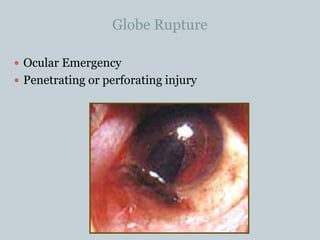 dokumen.tips_ocular-emergencies-ocular-emergencies-medical ...