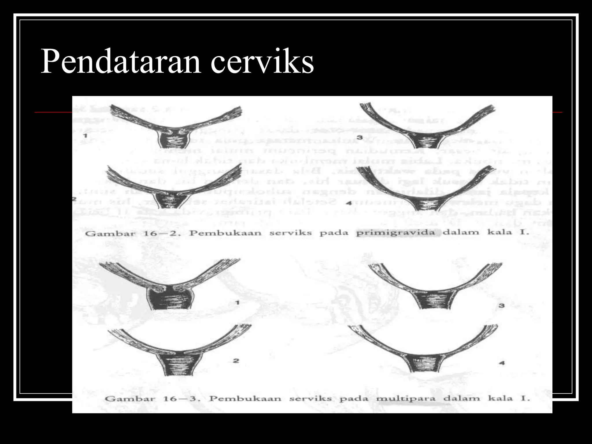 dokumen.tips_persalinan-normal-5660a5a7a933e.ppt