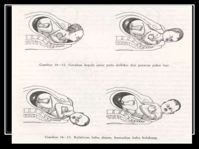 dokumen.tips_persalinan-normal-5660a5a7a933e.ppt