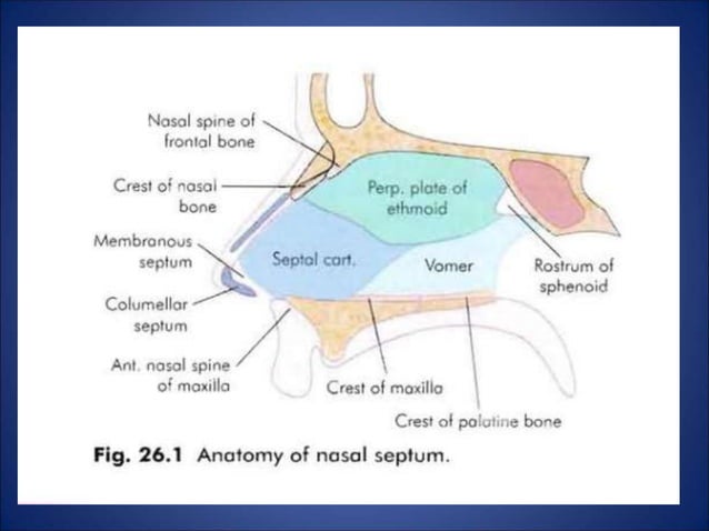 Septu dokumen.tips_deviated-nasal-septum-5584549c45f7b.ppt