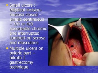 • Small ulcers :
elliptical incision-
mucosa closed –
simple continuous
– 3/0 or 4/0
absorbable chromic
and interrupted
Lambert on serosa
and muscularis
• Multiple ulcers on
pyloric part –
bilroth I
gastrectomy
technique
 