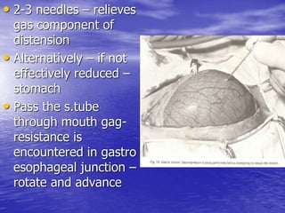 • 2-3 needles – relieves
gas component of
distension
• Alternatively – if not
effectively reduced –
stomach
• Pass the s.tube
through mouth gag-
resistance is
encountered in gastro
esophageal junction –
rotate and advance
 