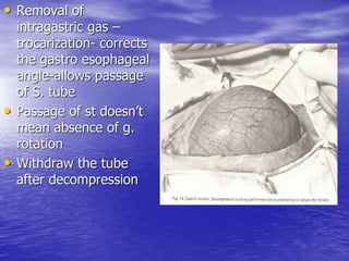 • Removal of
intragastric gas –
trocarization- corrects
the gastro esophageal
angle-allows passage
of S. tube
• Passage of st doesn’t
mean absence of g.
rotation
• Withdraw the tube
after decompression
 